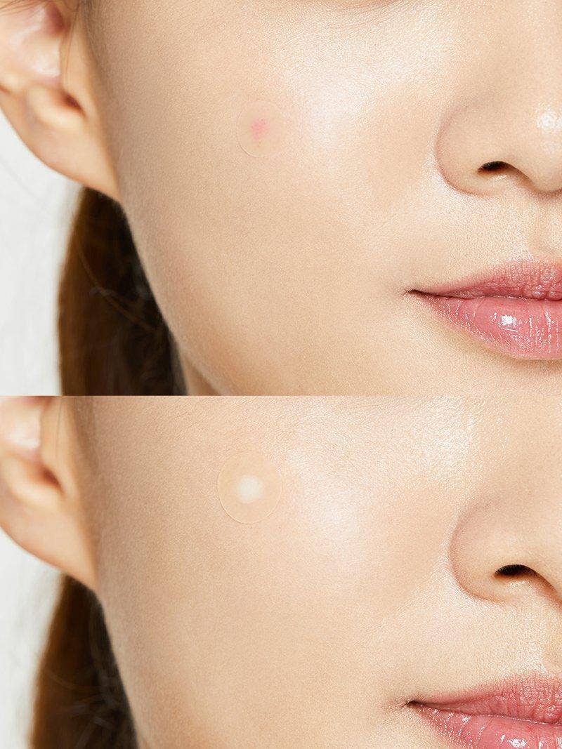 [COSRX] ACNE PIMPLE MASTER PATCH 24 PCS